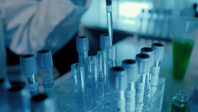 professional scientist is analyzing some liquid sample to test a new vaccine for terminate virus, in a laboratory has so many science equipment which is microscope, test tube and dropper