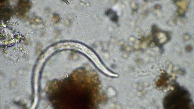 Soil under the microscopy, looking at sand, silt and clay and soil biology, amoebae, fungi, fungal, microbes and nematodes in a cattle farm in australia.