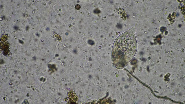 Soil under the microscopy, looking at sand, silt and clay and soil biology, amoebae, fungi, fungal, microbes and nematodes in a cattle farm in australia.
