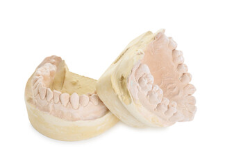 Dental model with jaws isolated on white. Cast of teeth