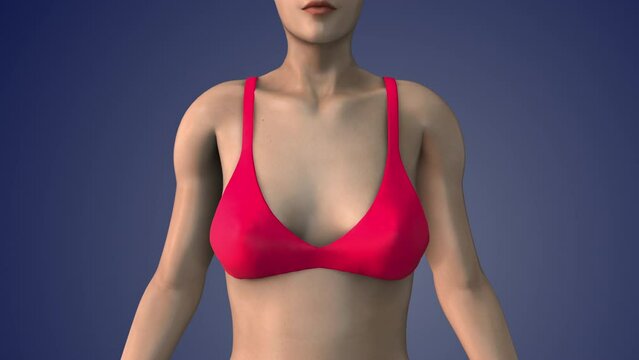 A breast lift is also known as mastopexy