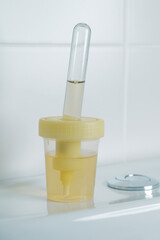 sterile container and tube with urine