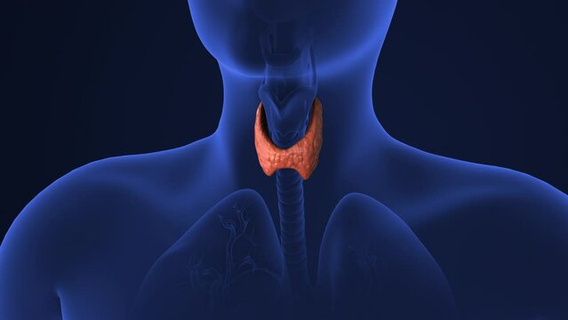 Medical concept of Thyroid gland cancer.