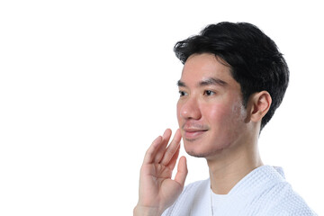 Man after facial laser treatment on white background. Aesthetic face treatment concept