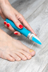 woman sanding her toenails with a sander, vertical photo. nail fungus. toenail disease. woman taking care of toenails. yellow toenail. electric nail grinder. caring for a sore toenail.