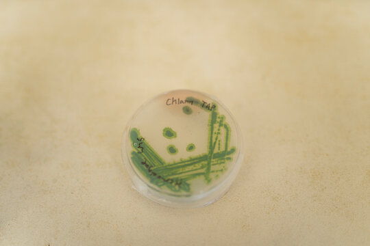 Petri dish with microbiological sample on table in laboratory