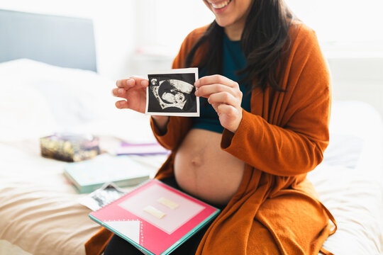 Baby ultrasound-sonogram picture