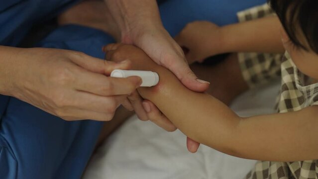 mother applying antiallergic cream on allergy with red spot at baby arm after red bite of mosquito