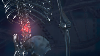The spine image for Backache or health and sci concept 3d rendering.
