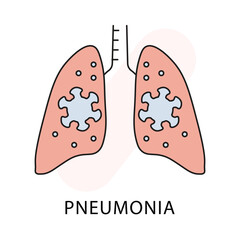 Detailed Pneumonia Icon - Medical Condition, Health, Respiratory Vector
Medical Illustration of Pneumonia - Health, Respiratory, Condition Icon with editable stroke.