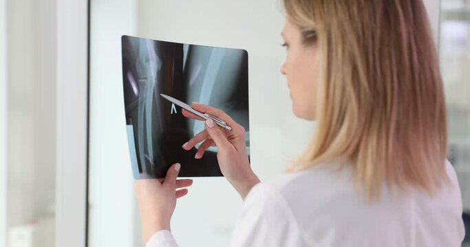 Woman physician examines X-ray image for signs of fractures