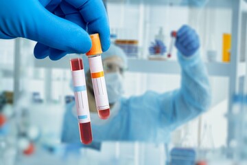 Hand hold test tube for blood sample