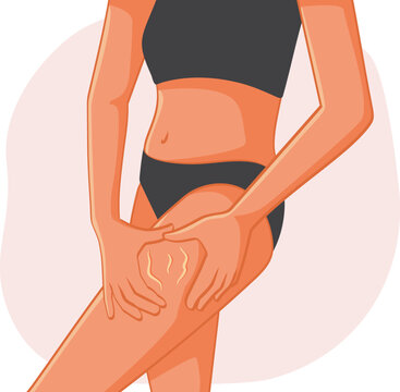 Woman Checking her Legs for Cellulite Vector Illustration. Insecure girl suffering from body dysmorphia from unrealistic beauty standards 
