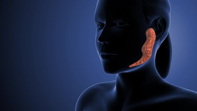 Parotid gland cancer medical animation