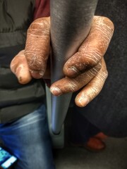 hands of person