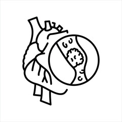 Thrombosis of the heart line black icon. Signs for web page