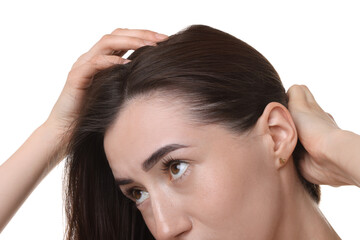 Fototapeta premium Young woman with hair loss problem on white background, closeup