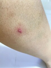 close up of a person with a pain