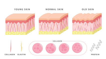 Aging process. comparison of young and aged skin. collagen, elastin and fibroblasts in younger and older skin. flat vector 2d illustration. Concept skin care cosmetics solution.