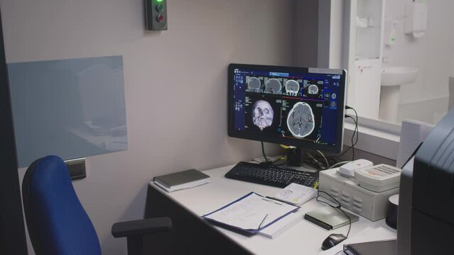No people shot of empty MRI control room with digital brain scan displayed on computer screen in hospital, after computer tomography procedure on injured patient