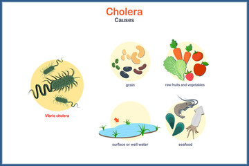 Causes of cholera in flat style