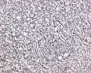 Human liver. Reticular fibers