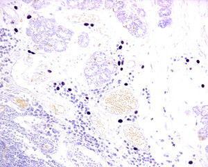 Obraz premium Mast cells