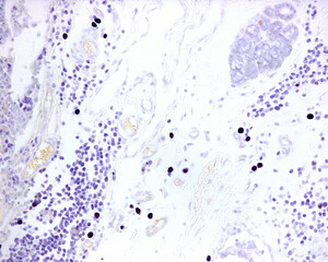 Mast cells