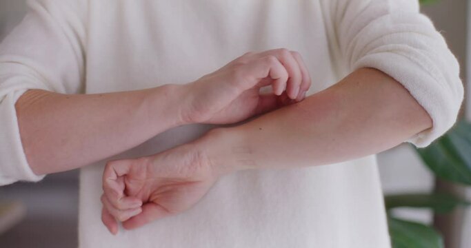 Woman Bitten by a Midge on the Forearm Red and Swollen Wound