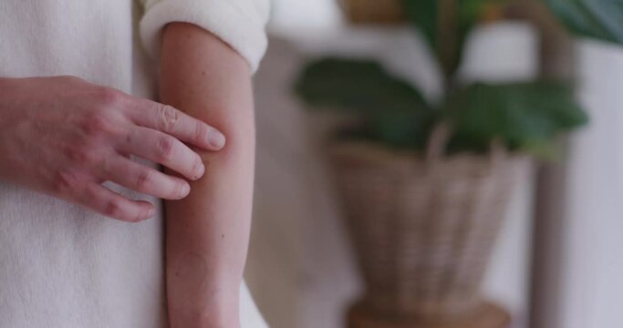A Woman Lubricates the Wound After an Insect Bite With a Gel That Reduces Swelling and Pain