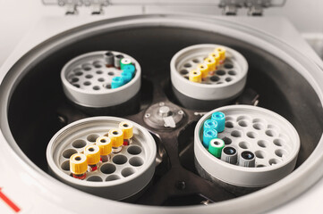 Container for tubes of biochemical analyzers Doctor removes from lab centrifuge. Platelet-Rich plasma preparation. Tube with plasma in hands clinical chemistry samples putting them to centrifuge	