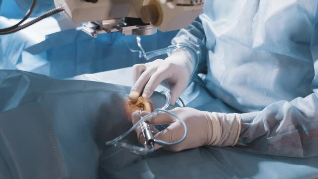 A surgeon looks through a microscope at a patient's eyes in the operating room. The doctor uses a microscope during eye surgery or diagnostics, cataract treatment and diopter correction.