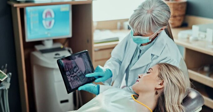 Woman, dentist and appointment in office with tablet, intraoral scan examination on tech. Orthodontist, teeth assessment and healthcare for oral hygiene, medical consultation and dental implant scan