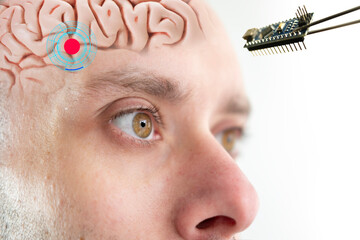 Installing electronic chip into human brain, applied in various fields neurotechnology and medical...