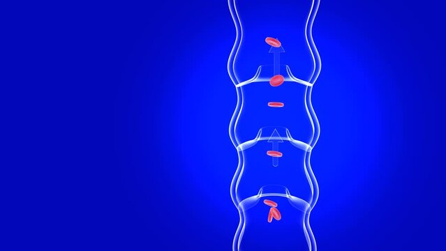 Anatomical 3d animation of a diseased and incompetent vertical vein. Valves malfunction accumulating red blood cells. Transparent image of glass on a blue background.