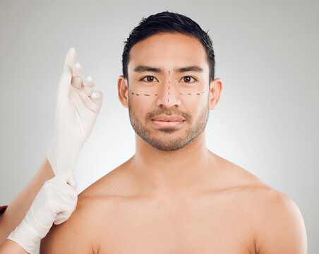Male person, hands and drawing marks on face for plastic surgery, rhinoplasty and cosmetic procedure in studio. Man, surgeon and needle or syringe placement for facelift, nose job and blepharoplasty