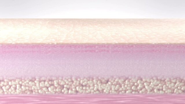 Skin dry dead cells exfoliation. Dry, rough, bumpy skin outer layer peeling away from the body surface. The human skin tissues cross-section in macro zoom. Skin care 3D animation