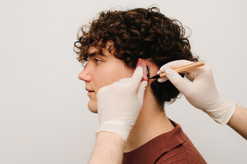 Otoplasty markup making on ear. Surgeon drawing markup lines before Otoplasty surgeon on ears....