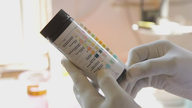 A laboratory technician is comparing a reagent strip (dipstick) for urinalysis with reference colour chart values.