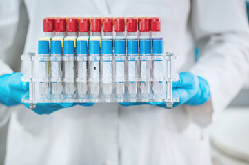 hand in medical glove holds test tube closeup without face in bio laboratory. Doctor takes tests....