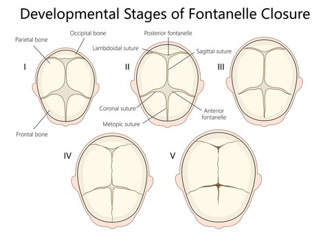 developmental stages of fontanelle closure in infants, detailing sutures and bone structure of the skull diagram hand drawn schematic raster illustration. Medical science educational illustration
