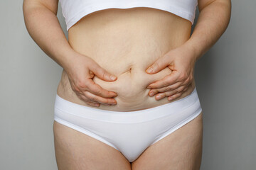 Closeup women waist with thick fat tummy. Female abdomen, lady plus size big belly