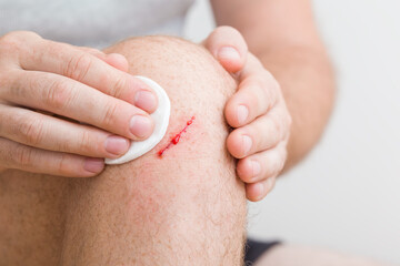 Young adult man hand fingers using white cotton pad and cleaning bleeding red abrasion knee skin...