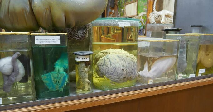 Internal organs of human and animals. Animals internals in glass jars with formaldehyde for medical research in institute, among which fertile horn of uterus, cow brain, lizard and real human brain