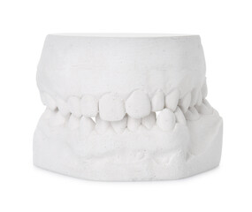 Dental model with gums isolated on white. Cast of teeth