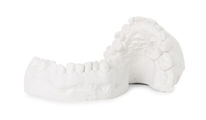 Dental model with gums isolated on white. Cast of teeth