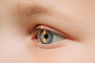 Obraz premium Examination of the child using a slit lamp. Microscope and focused light source. A device for high-precision examination of the eye to determine the condition of the lens.