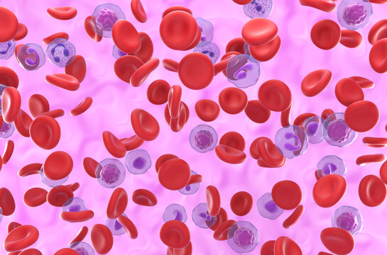 High level of Red blood cell in Polycythemia vera (PV) - isometric view 3d illustration