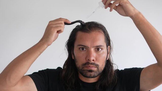 man using roller hair on his scalp to prevent baldness,  Thinning hair