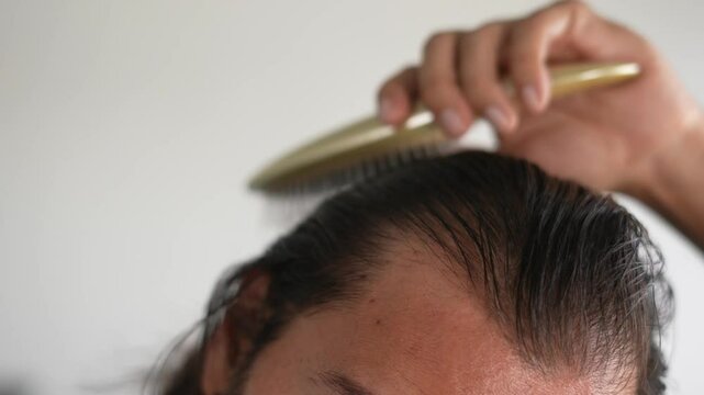 man using brush on his head with baldness, Detangler